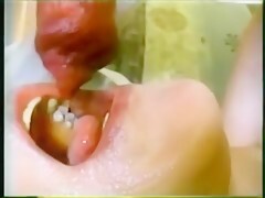 Thumb 17
